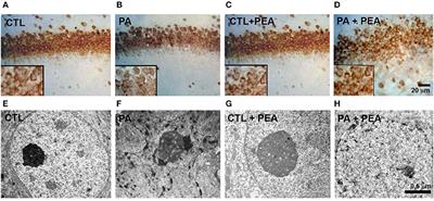 <mark class="highlighted">Palmitoylethanolamide</mark> Ameliorates Hippocampal Damage and Behavioral Dysfunction After Perinatal Asphyxia in the Immature Rat Brain